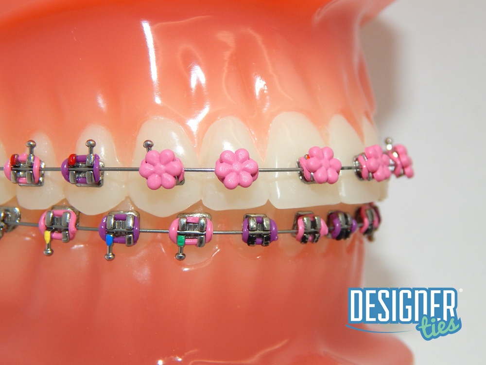medical grade manual orthodontic flower ligature ties cartoon elastic rubber bands for braces colorful high strength ce